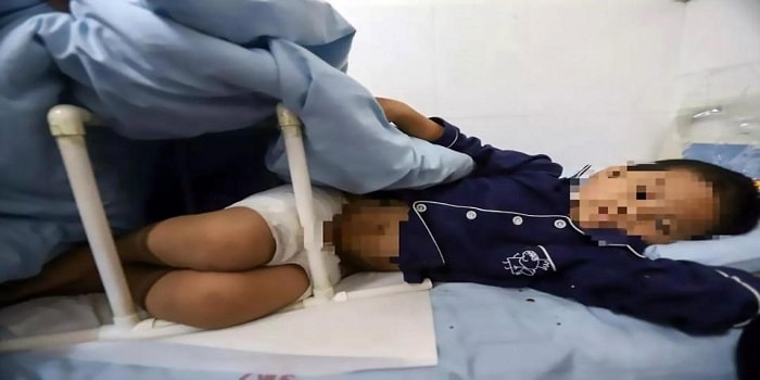 Bimbo di sette anni seviziato dalla nuova moglie del padre: “Gli ha ustionato i genitali con l’acido”