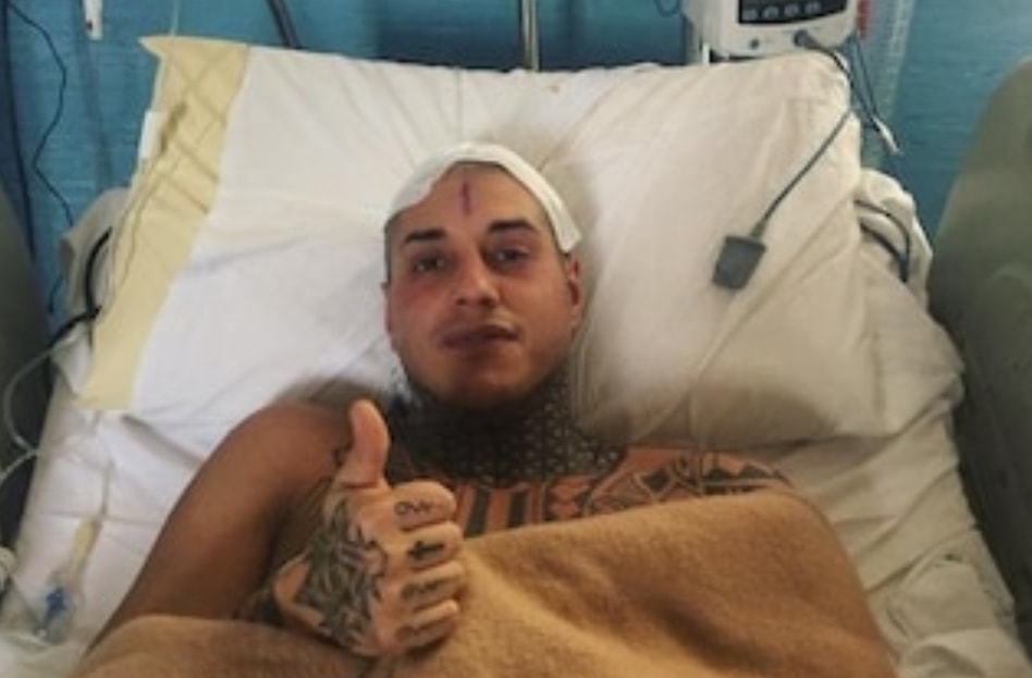La prima foto di Francesco Chiofalo dopo l’intervento: “Ce l’ho fatta, sto bene”