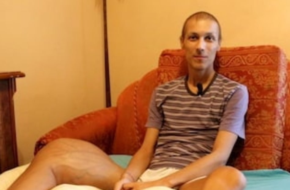 Luca Cardillo è morto: addio al 23enne che combatteva contro un raro tumore alla gamba