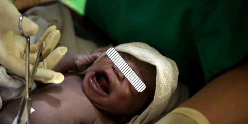 Rissa in ospedale a Napoli, nasce figlio nero: padre sfonda sala parto