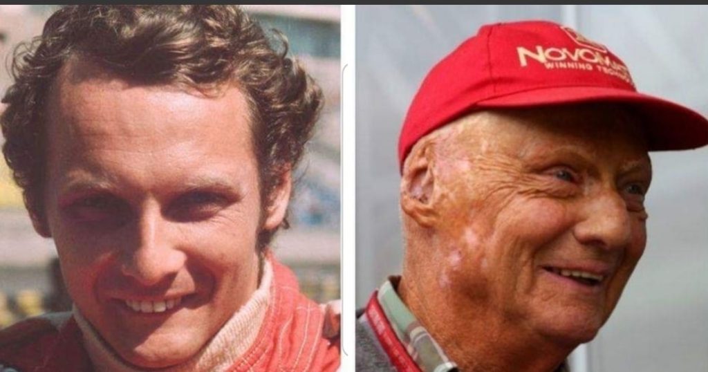 Niki Lauda è morto: il campione della Formula Uno aveva 70 anni