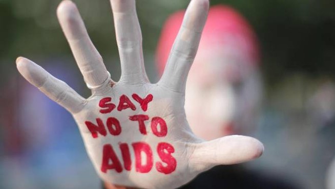 Aids sconfitto, la fine del Virus: non si trasmetterà più