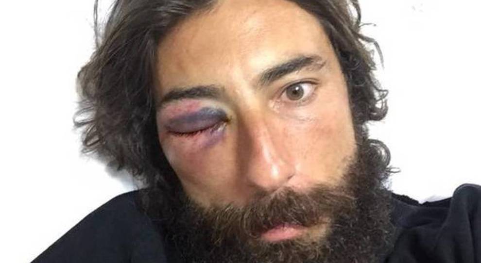 Ennesima aggressione subita da Vittorio Brumotti: ricoverato in ospedale
