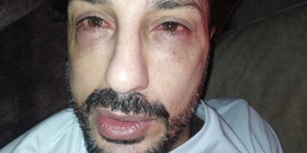 Fabrizio Corona rischia di perdere la vista: “Sto male”