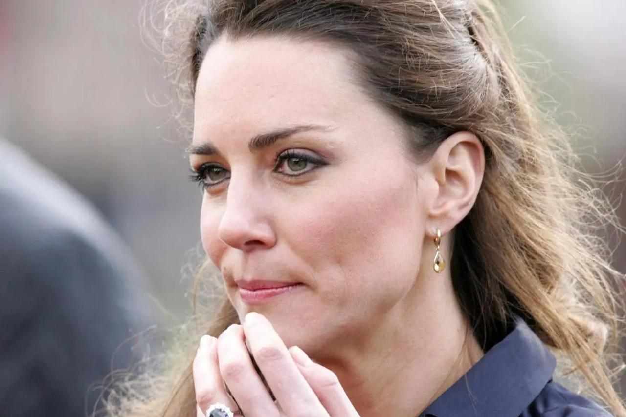 Kate Middleton picchiata a sangue | Il suo viso è pieno di lividi: la FOTO non adatta ai più sensibili